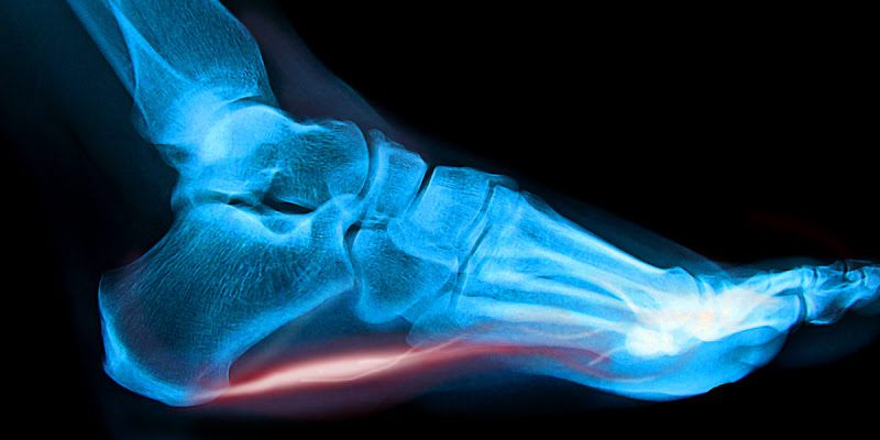 The Foot Institute: Angelo Morreale, DPM